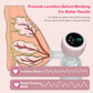 Electric Breast Pump
